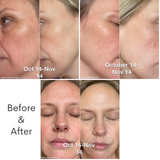 Chebula Tranexamic Acid Pigmentation Serum 45ml